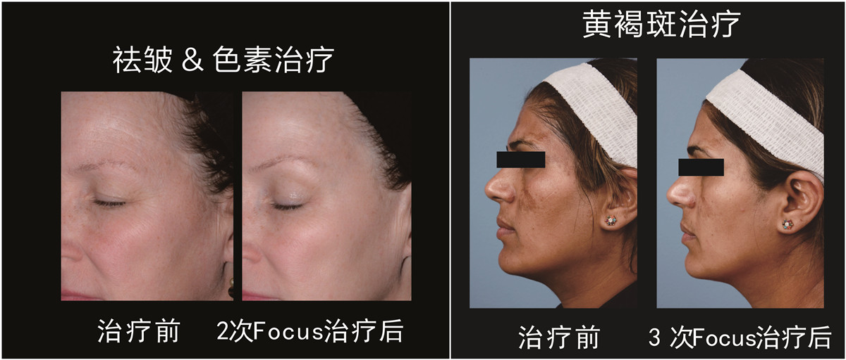 1_副本.jpg 1_副本.jpg